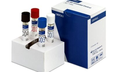 Qualidade no banco de sangue: controle interno e externo em imuno-hematologia