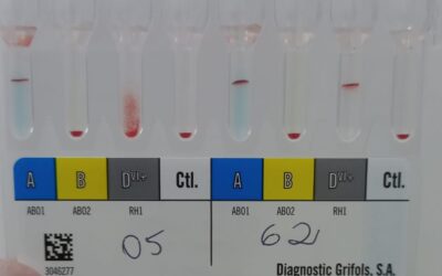 Imuno-hematologia nos laboratórios de análises clínicas: por que esses testes importam (e por que eles geram tantas dúvidas)