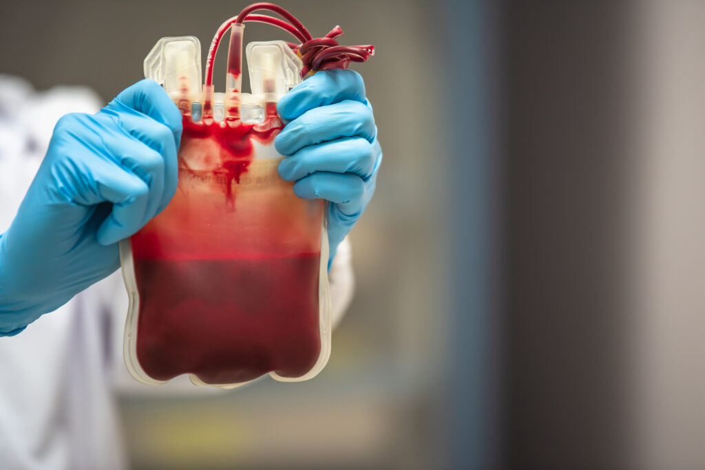 Aloimunização eritrocitária: por que prevenir começa muito antes da transfusão