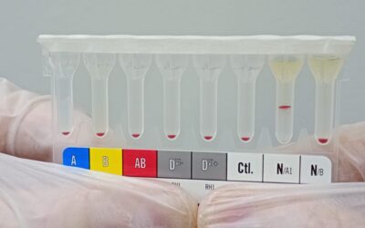 Tipagem ABO direta e reversa: por que as duas são importantes?