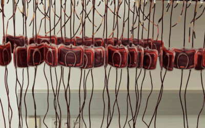 Da veia à bolsa: por que os leucócitos são considerados vilões silenciosos da transfusão