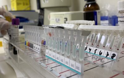 Controle de qualidade em imuno-hematologia: como garantir que seus reagentes realmente estão funcionando?