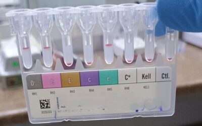 Por que fenotipar os doadores de sangue para Rh e Kell?
